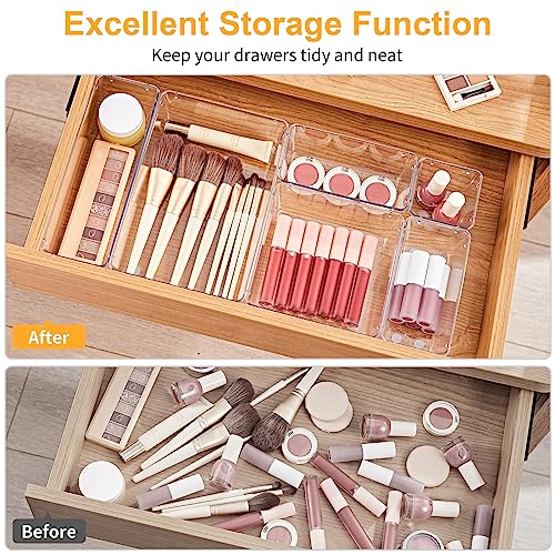 SMARTAKE 22-Piece Drawer Organizer with Non-Slip Silicone Pads, 5-Size | Clear Desk Bathroom Drawer Organizer Trays Storage Tray for Makeup, Jewelry, Utensils in Bedroom Dresser, Office and Kitchen - size: 22 PCS