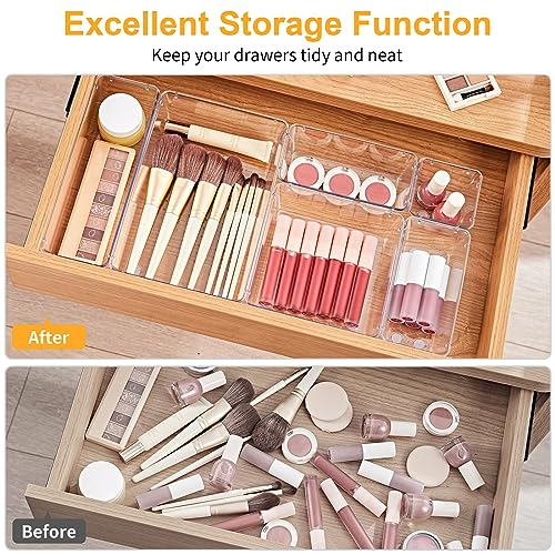SMARTAKE 13-Piece Drawer Organizers with Non-Slip Silicone Pads, 5-Size | Clear Desk Bathroom Drawer Organizer Trays Storage Tray for Makeup, Jewelry, Utensils in Bedroom Dresser, Office and Kitchen - size: 13 PCS